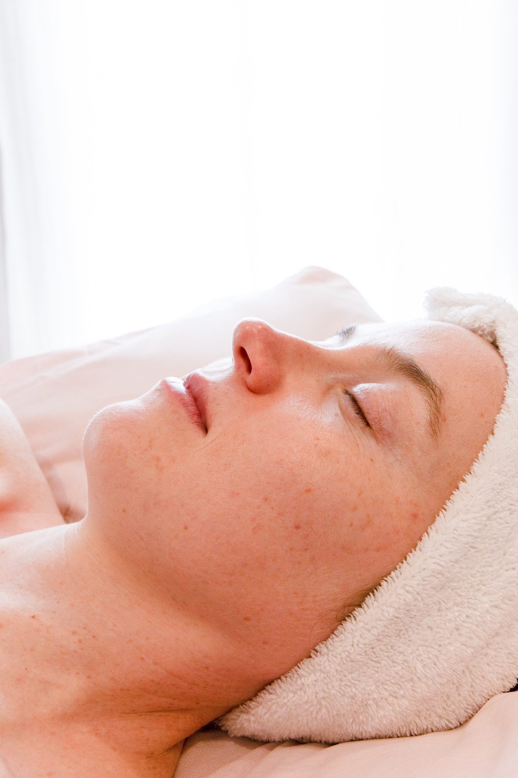 Microneedling treatment with Mesopen Pro